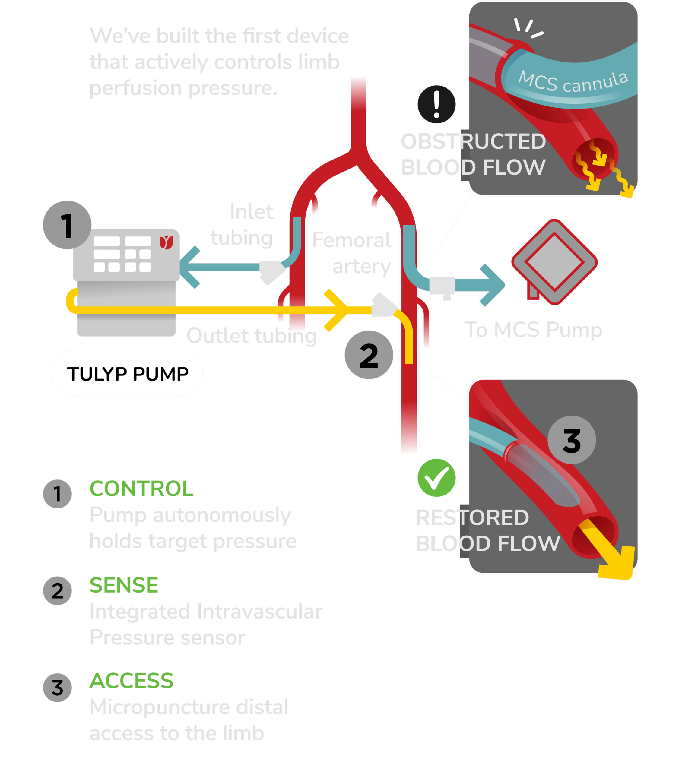 The Tulyp intelligent, purpose-built perfusion platform and its components