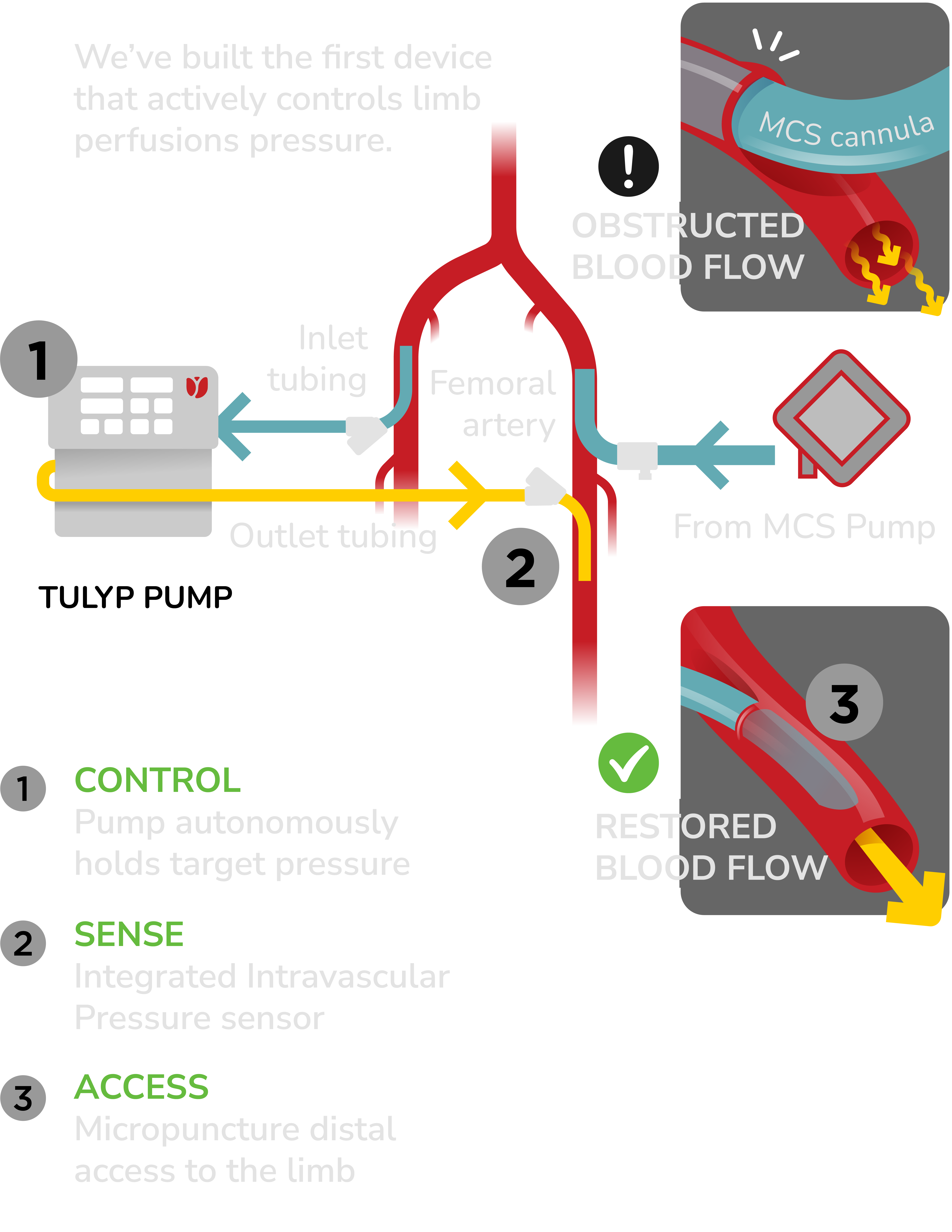 The Tulyp intelligent, purpose-built perfusion platform and its components