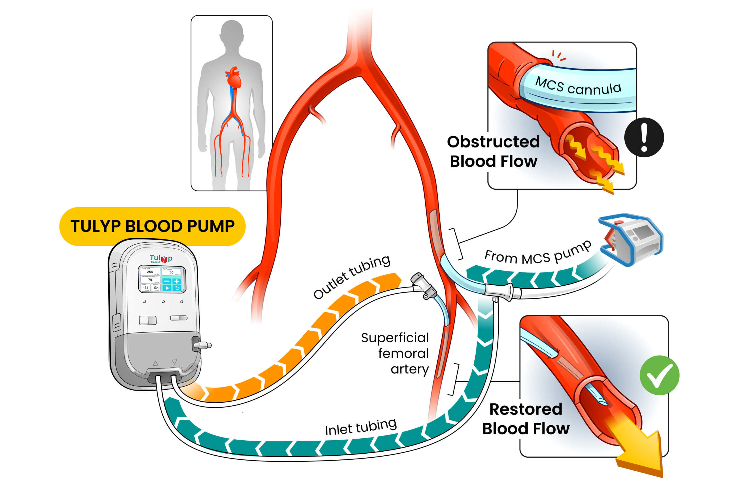 Tulyp closed-loop perfusion system diagram
